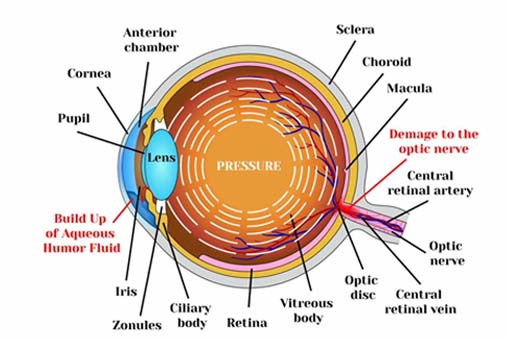 Anterior Segment Surgery